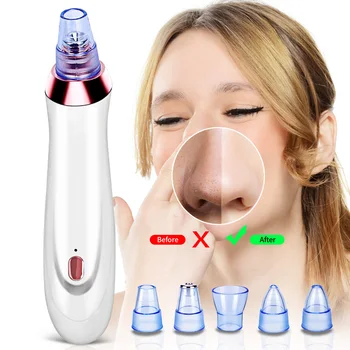 

Blackhead Remover Pore Cleaner Skin Care Pore Vacuum Acne Remover Pimple Removal Vacuum Facial Face Clean