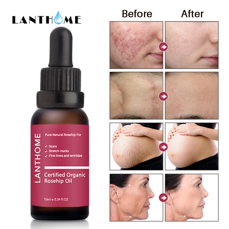 organic skincare for sensitive skin