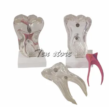 

1pcs 4 times teeth dental implant analysis model crown bridge demonstration dental teeth model tools dentist model study