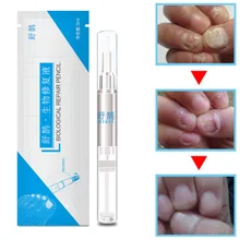Высококачественная жидкость для ухода за ногтями, яркая питательная Очищающая Ручка для ног