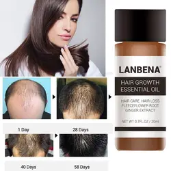 1 Bottle 20 ml Powerful Fast Hair Growth Essential Oil Treatment Anti Hair Loss Natural Hair Care Liquid For Men/ women TSLM2
