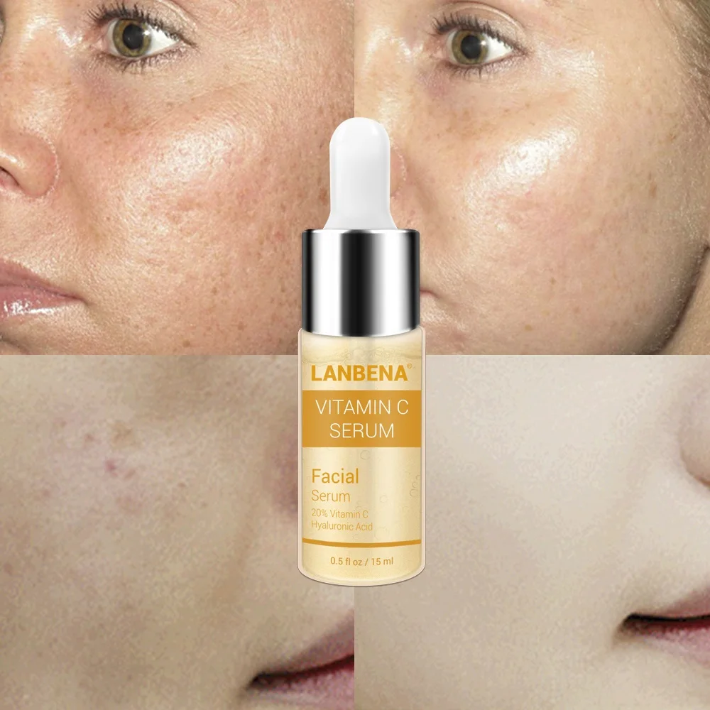 

LANBENA Vitamin C Whitening Face Serum Removing Dark Spots Freckle Speckle Fade Dark Spots Anti-Aging Essence Liquid Skin Care