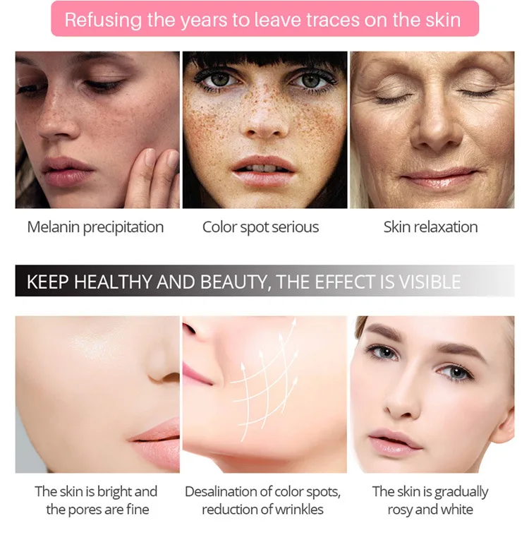 snmlpm freckle cream