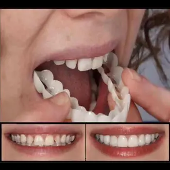 

Upper False Fake Tooth Cover Snap On Immediate Smile Cosmetic Denture Care Beauty Tool X7YB