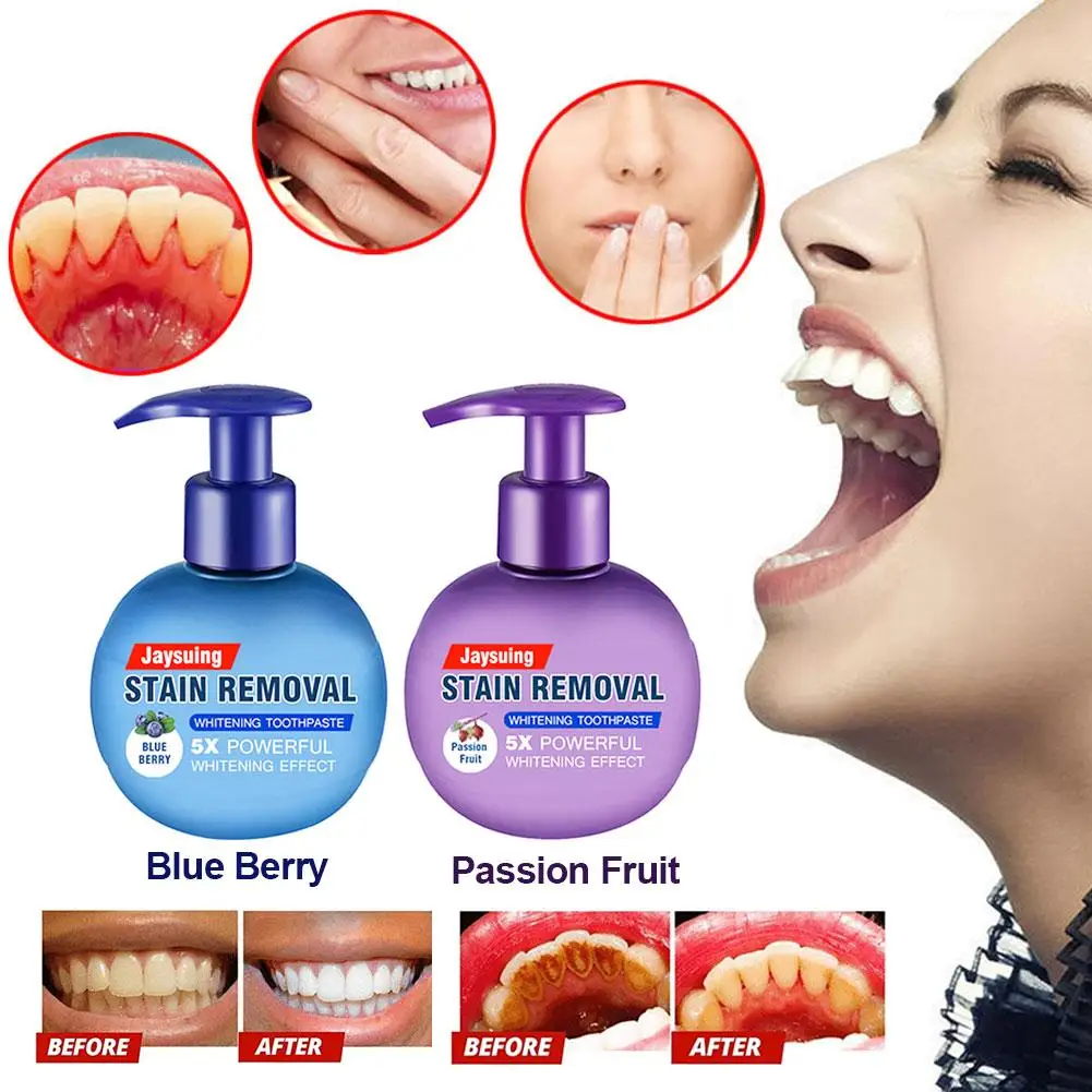 Strengthening Stain Removal Gel Toothpaste Whitening Toothpaste Fight Bleeding Gums White Toothpaste Fresh Breath Oral Care 5