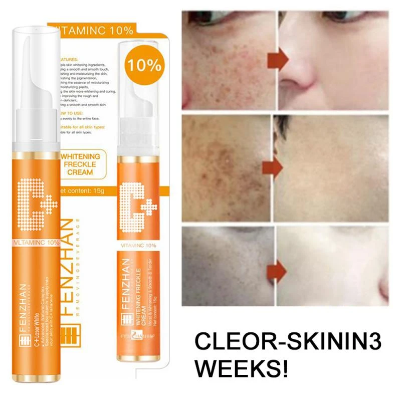 whitening freckle cream