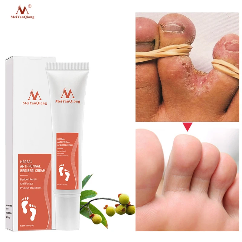 Травяная медицина крем для ног Лечение грибка красота здоровье - Цена: 589,24 руб.