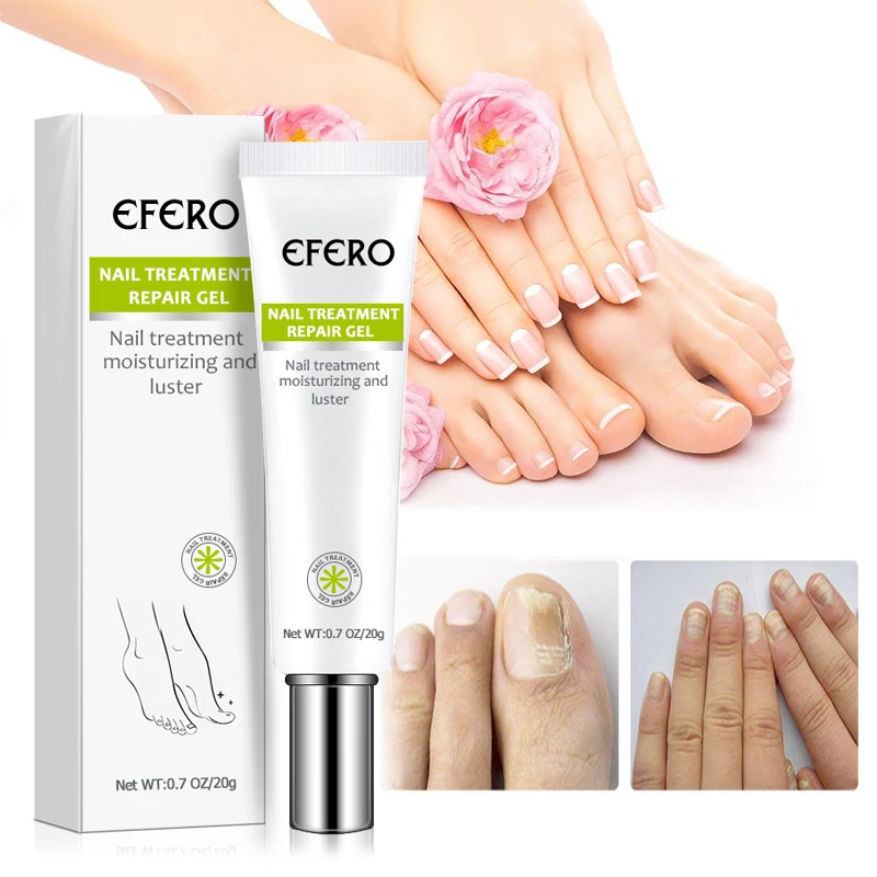 

Fungals Nail Repair Serum Fungal Nail Treatment Serum Remove Onychomycosis Toe Nail Fungus Essence Nourishing Hand Foot Care