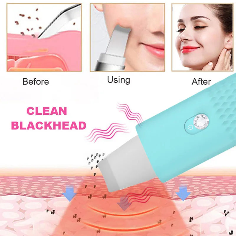 Professional Ultrasonic Facial Skin Scrubber Ion Deep Face Cleaning Peeling Rechargeable Skin Care Device Beauty Instrument