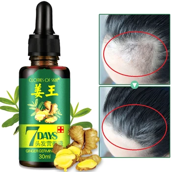 

30ml Hair Growth Oil Unisex Thinning Hair Stimulating Conditioner Supplement Anti Hair Loss Hair Growth Care Complex Vitamins