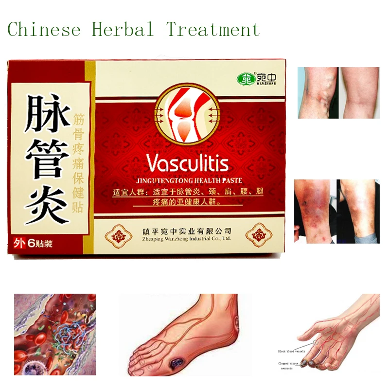 24PCS Chinese Traditional herbal medicine Patches Cure Spider Veins Varicose Treatment Plaster Varicose Veins Vasculitis Natural