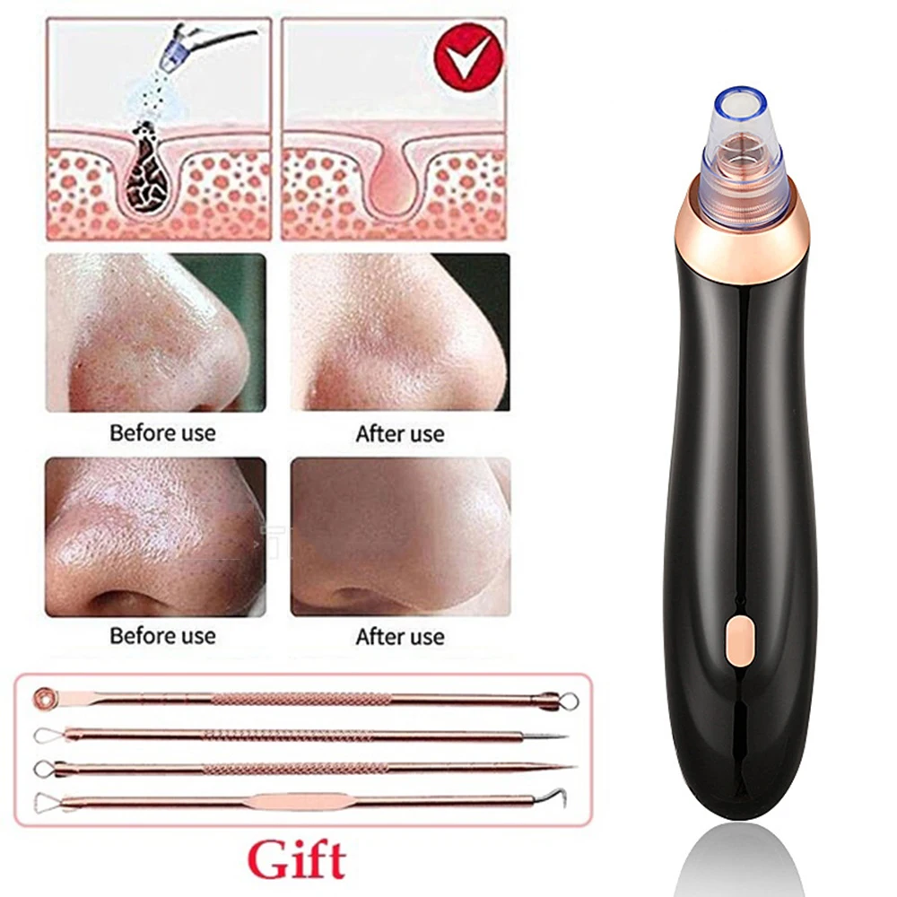 5cebb0b79795ee4c26f2d07d-1-large