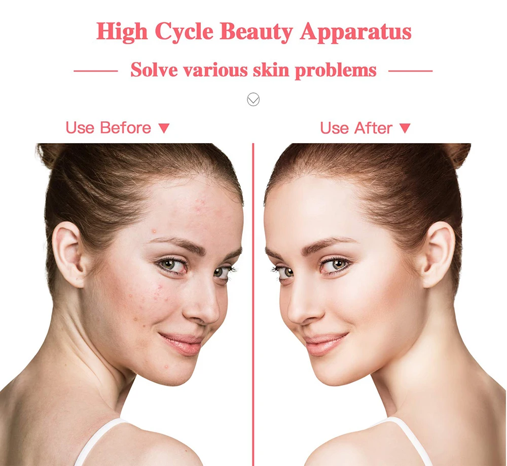 High Frequency Electrotherapy Wand Glass Tube Acne Spot Remover Bactericidal Tag Hair Body Facial Spa Beauty Skin Care
