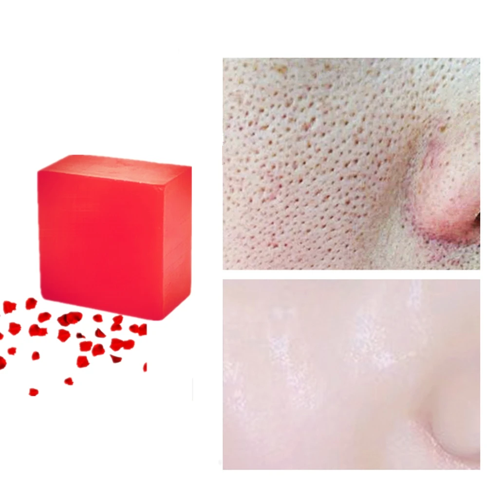 Новое очищающее средство для сушки пор, средство для мытья лица, розовая эссенция, мыло, Отбеливающее, нестареющее, против морщин