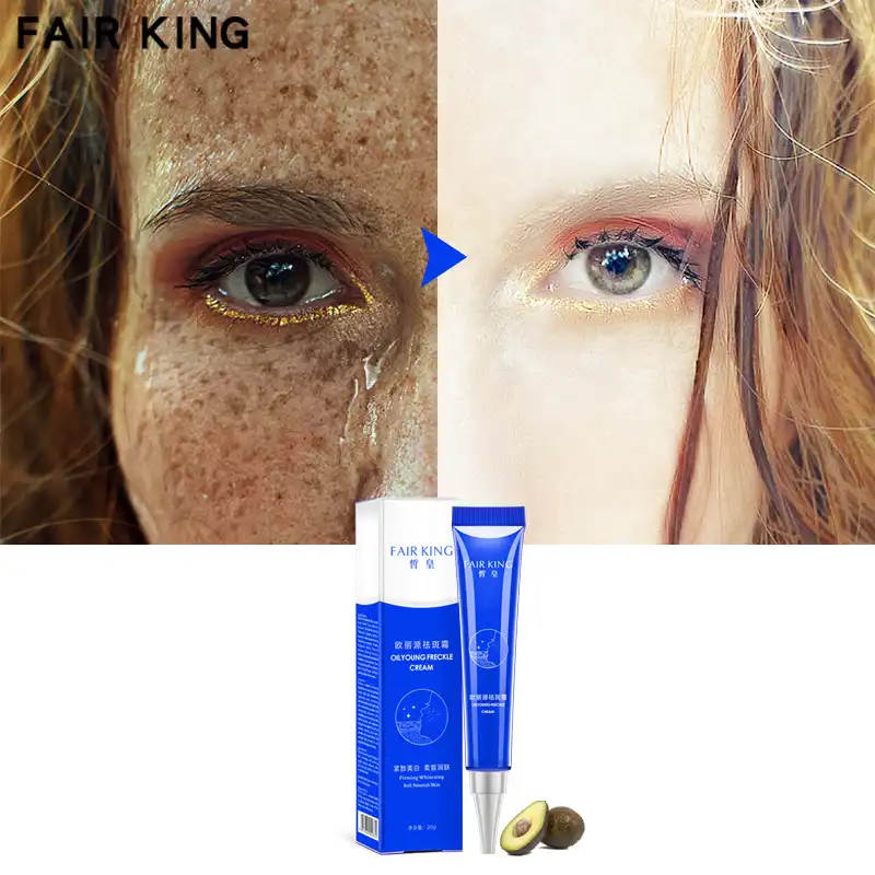 fair & clear cream treatment of freckles