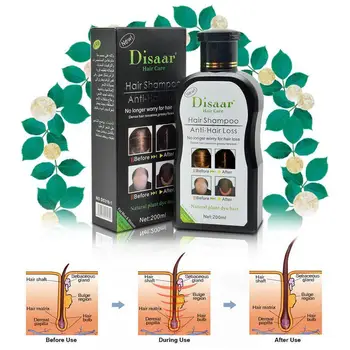 

professional Shampoo For Hair regrowth Anti hair Loss For Men Growth Treatment Prevent Women Product Hair & Hair Y6V0