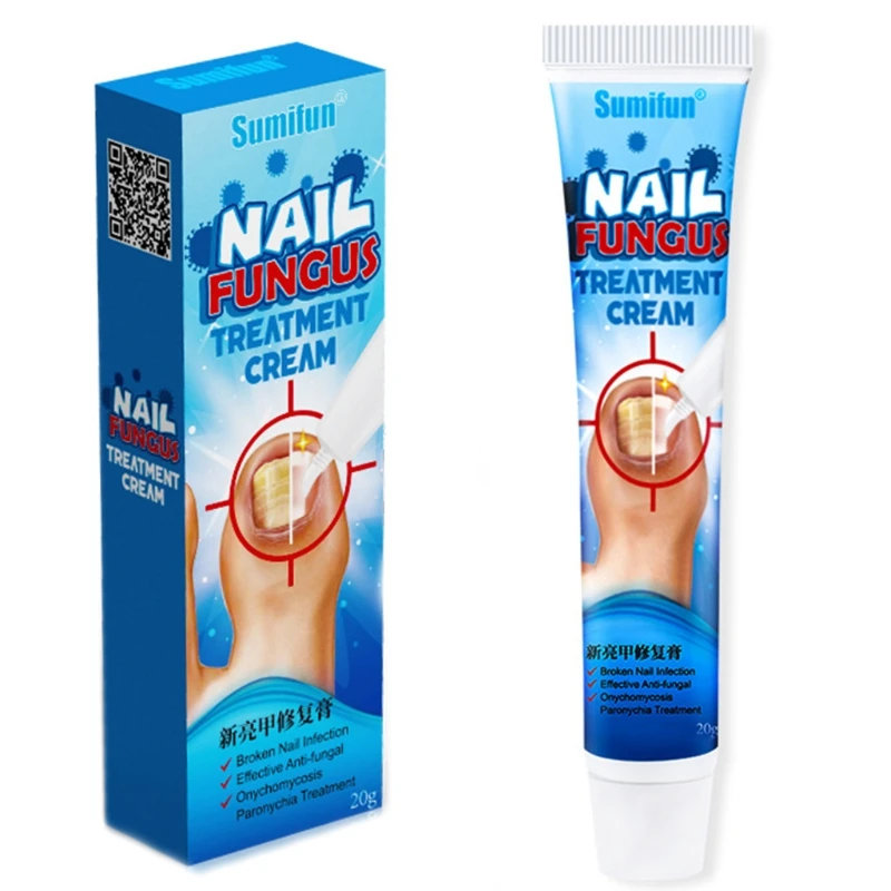 20g Chinese Herbal Toe Nail Fungus Treatment Cream Onychomycosis
