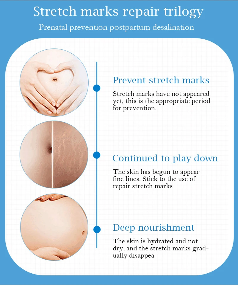 12753362513_844614343