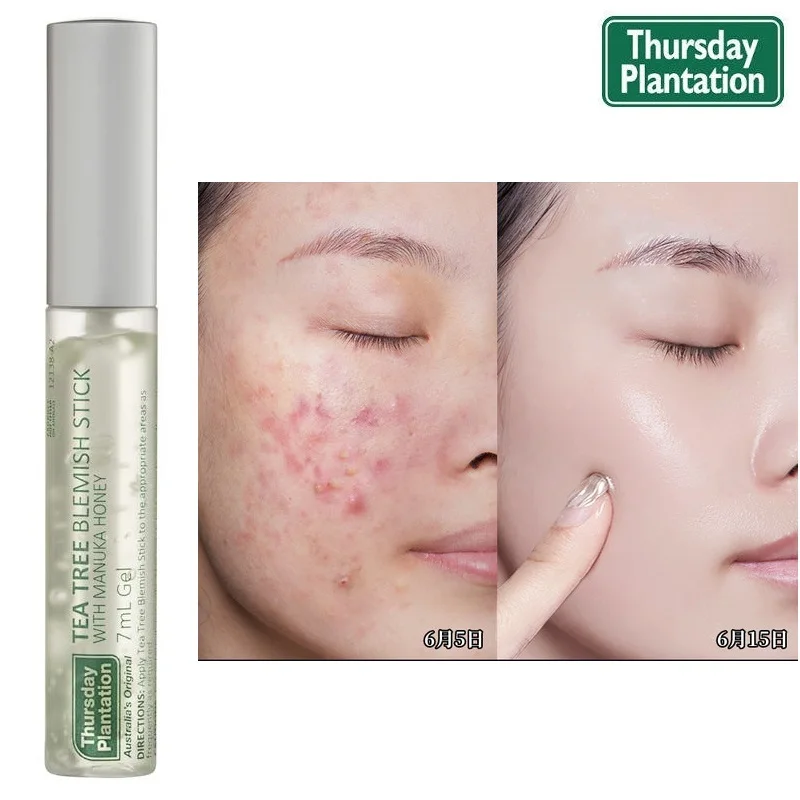 Thursday Plantation Tea Tree Blemish Stick 7ml (2)