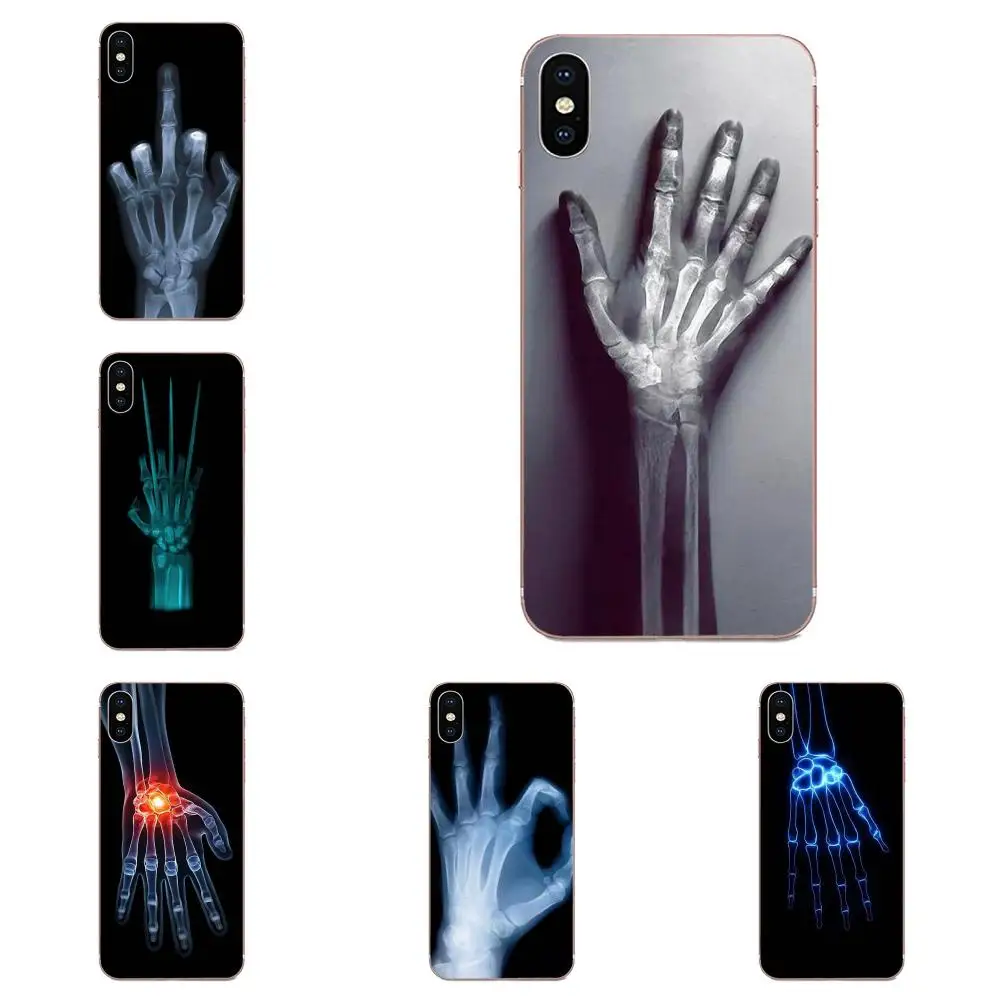 Wolverine X-ray Hand Bones Poster New For Galaxy Alpha Note 10 Pro A10 A20 A20E A30 A40 A50 A60 A70 A80 A90 M10 M20 M30 M40 | Мобильные