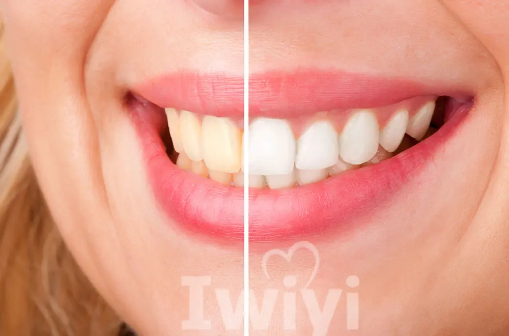 16LED лоток для рта для помощи отбеливанию зубов Гелевые полоски ручка для получения лучшего эффекта отбеливания зубов 3D Белый Уход за полостью рта устройство для ухода за зубами