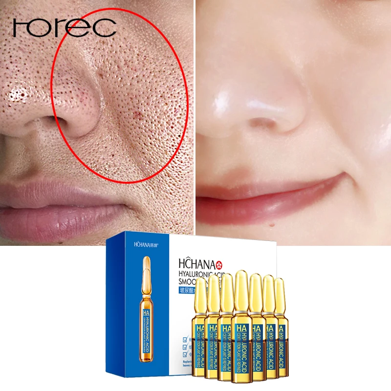 

ROREC Hyaluronic Acid Ampoule Face Serum Shrink Pores Anti-Acne Nicotinamide Whitening Moisturizing Anti-Aging Wrinkle Skin Care