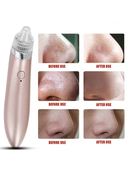 

Blackhead Pore Cleaner Remover Face Deep Acne Removal Suction Black Spot Cleaner Suction Facial SPA Diamond Skin Care Machine