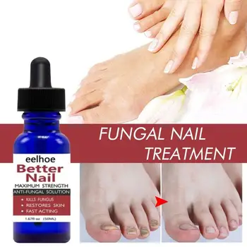 

50Ml Nail Repair Liquid Anti Fungal Toe Serum Remove Nail Onychomycosis Essence Nail Treatment Liquid Hand Foot Care