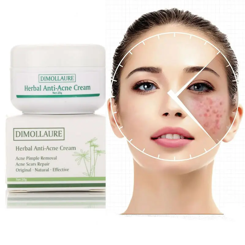 Dimollaure Acne Treatment Cream Blackhead Remova Anti Acne Cream Oil