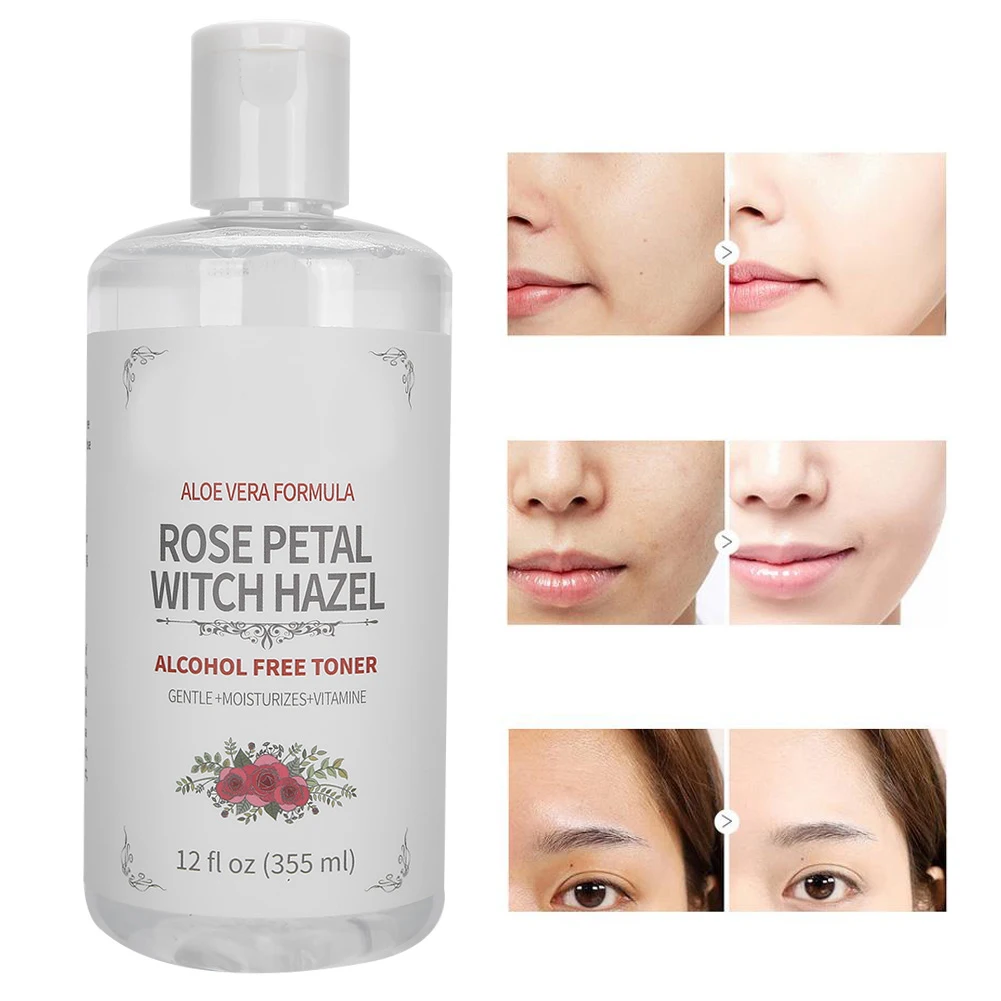 does witch hazel hydrate skin