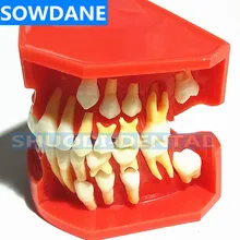 Dental Children Deciduous Teeth Model Replacement Model Permanent Teeth Alternate Display Removable Demonstration for Teaching цена Dental Children Deciduous Teeth Model Replacement Model Permanent Teeth Alternate Display Removable Demonstration for Teaching цены онлайн