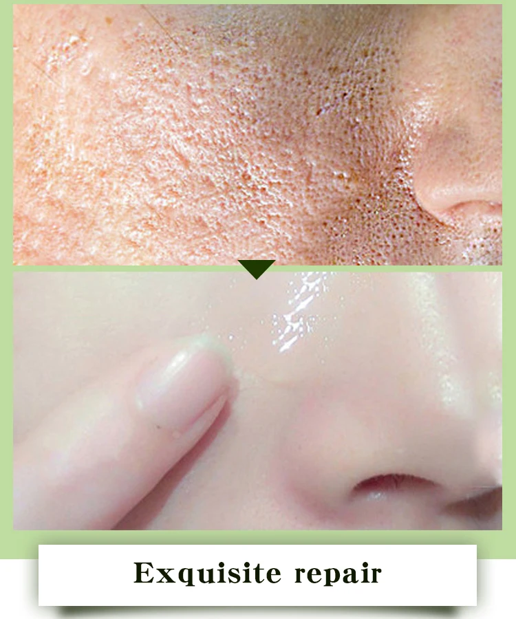 10ml MABREM Pomegranate Fine Pores Face Serum Whitening Plant Skin Care Anti Aging Anti Wrinkle Cream Reduce Acne Marks Care