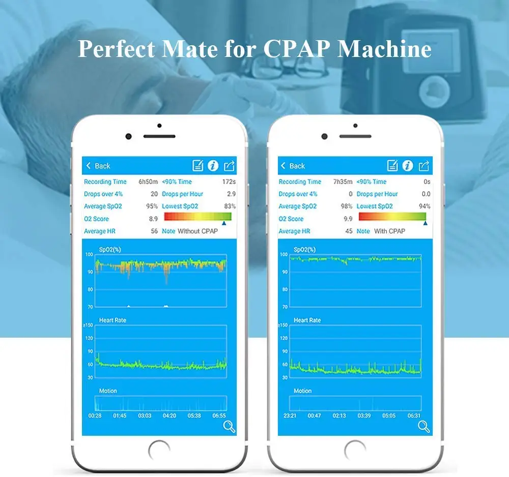 Носимый пульсоксиметр с вибрационным оповещением для апноэ сна копд храп приложение ПК отчет мат CPAP машины FDA Viatom Checkme O2