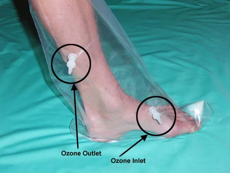Мешки для озона для рук или ног