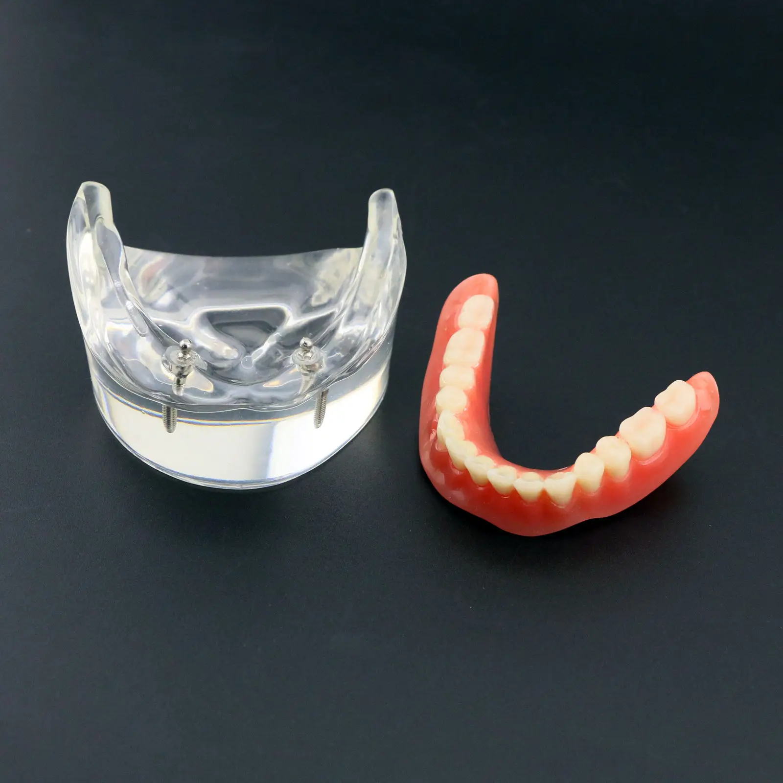 Стоматологическая Overdenture уступает с 2 имплантатами Demo модель исследования модель