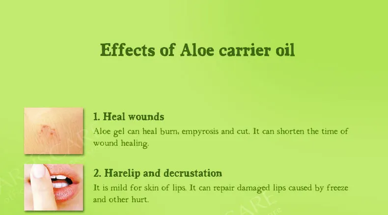 aloe_05