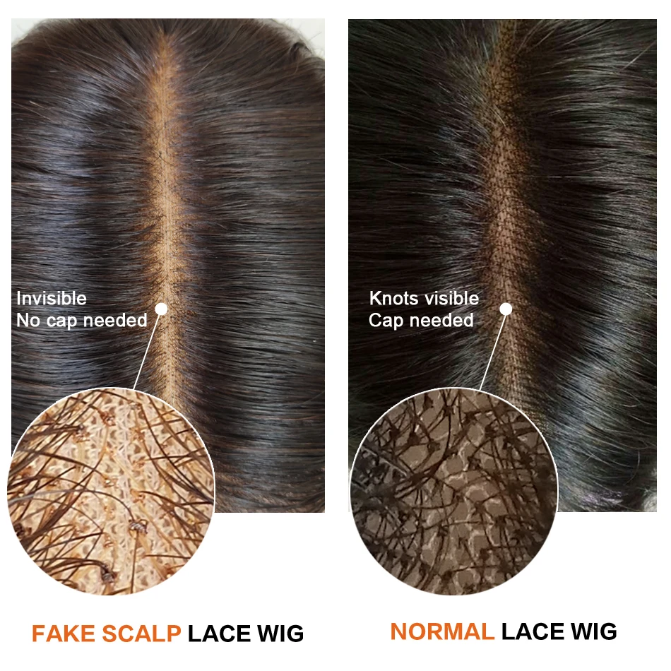 fake scalp vs normal
