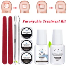 1 компл. Вросший носок коррекция ногтей проволока устройство фиксации для педикюра Paronychia восстановление персонифицированный фен инструмент для ухода за ногами