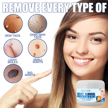 

Warts Remover Antibacterial Ointment Wart Treatment Cream Skin Tag Remover Herbal Extract Corn Plaster Warts Ointment All Skin