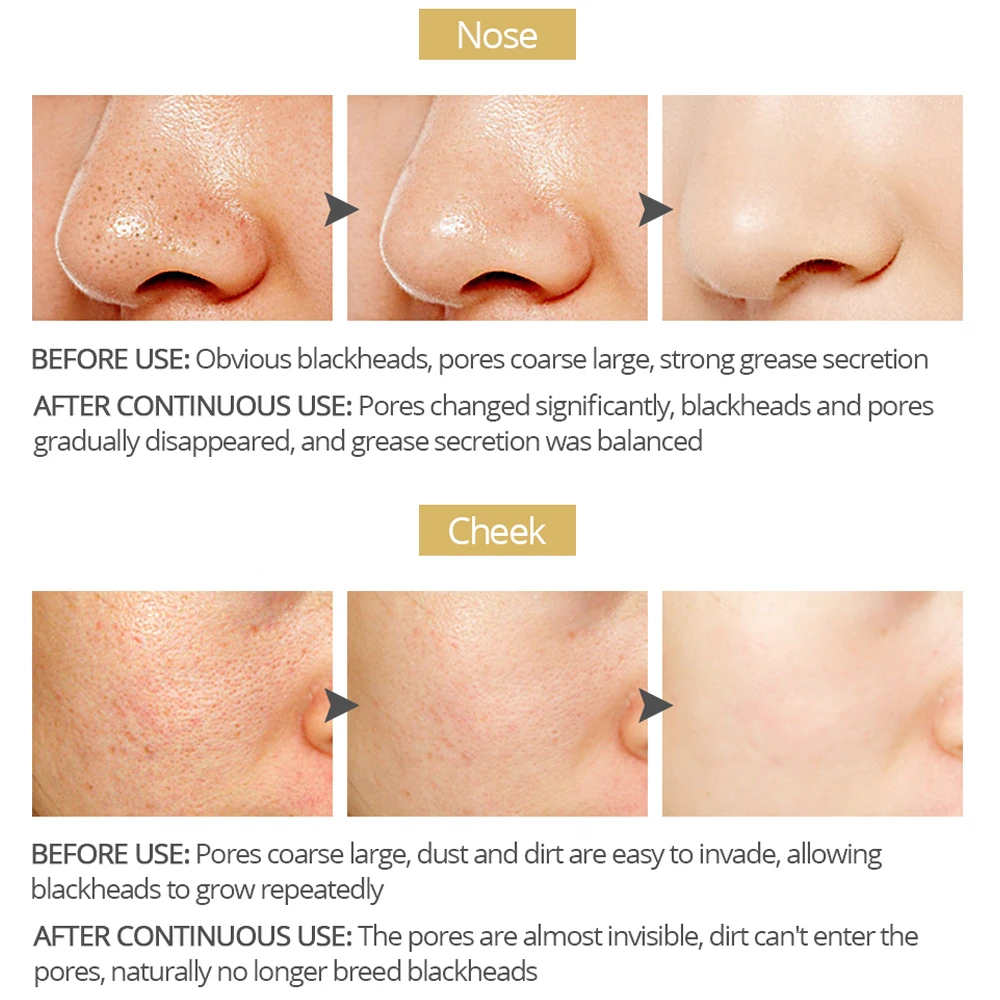 VIBRANT GLAMOUR Nose MaskNew Bamboo Charcoal Blackhead RemoverPore Moisturizing Peeling Mask Deep Cleansing Shrink Skin Care 4