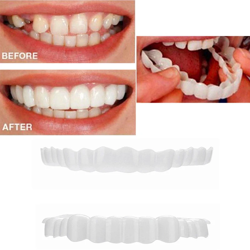 H Silicone Soft Orthodontic Brace Buck Teeth Retainers Boxing Tooth Protector Dental Dientes Postizos Que Encajan 2