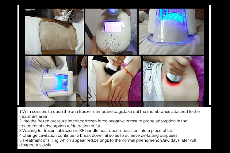 High quality cryotherapy slim freezer weight loss device/cryolipolysis cavitation rf slimming products