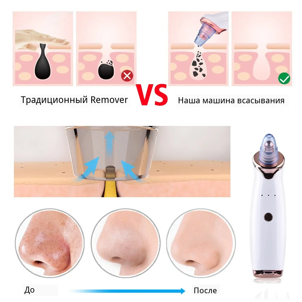 HTB1uqp8XzLuK1Rjy0Fhq6xpdFXa1