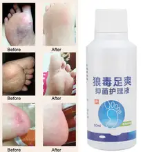 Парфюм для тела 60 мл дезодорант для ног спрей для ног плохой запах удаление Антибактериальный жидкий Уход за ногами спрей для взрослых