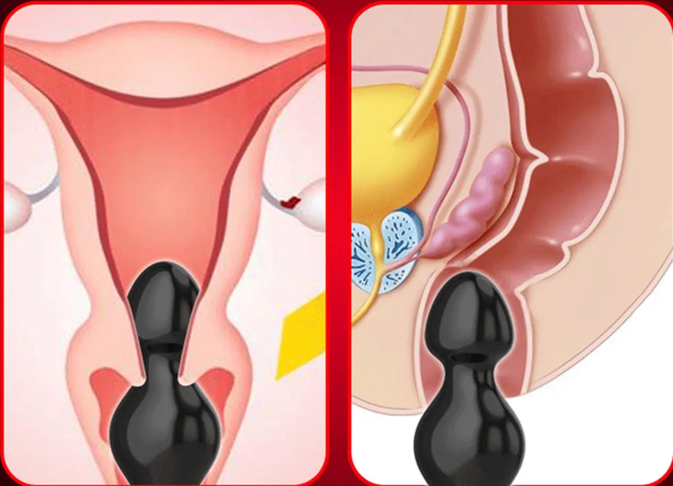 10182871637_1173438795