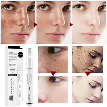 

Whitening Cream Whiten Skin Lighten Spots Chloasma Maternal Spots Age Spots Sunburn Sodium Hyaluronate Propyl Paraben 15g