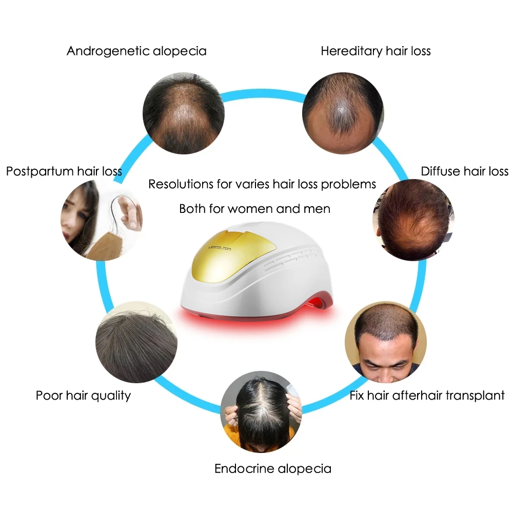 Lescolton Laser Hair Growth Helmet Laser Hair Regrow 80 Medical Diode Cap  Lllt Hair Loss Treatment Device Caps For Men And Women - Hair Growth  Devices - AliExpress