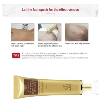 

30g Ance Scar Removal Cream Moisturizing Gel Ointment Scar Care Repair For Skin Effectively Surgical Stretch Marks K3K0