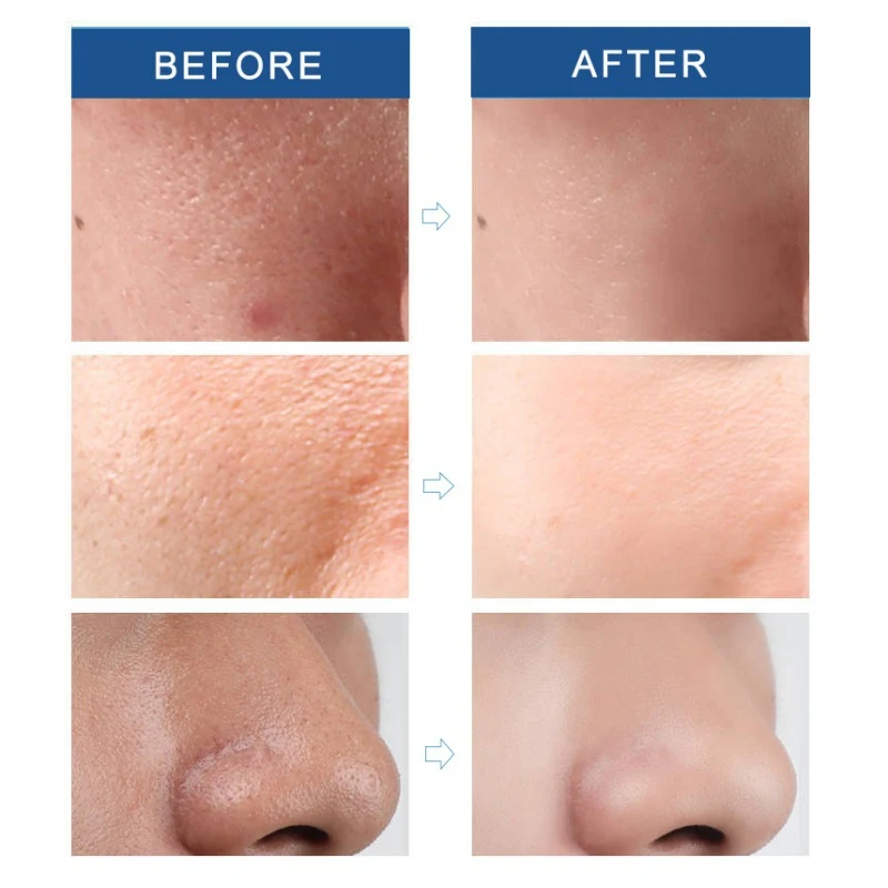 30ml Pores Shrinking Serum Face Serum Anti-Aging Shrink Pore Whitening Moisturizing Essence Face Cream Dry Skin Care Pro
