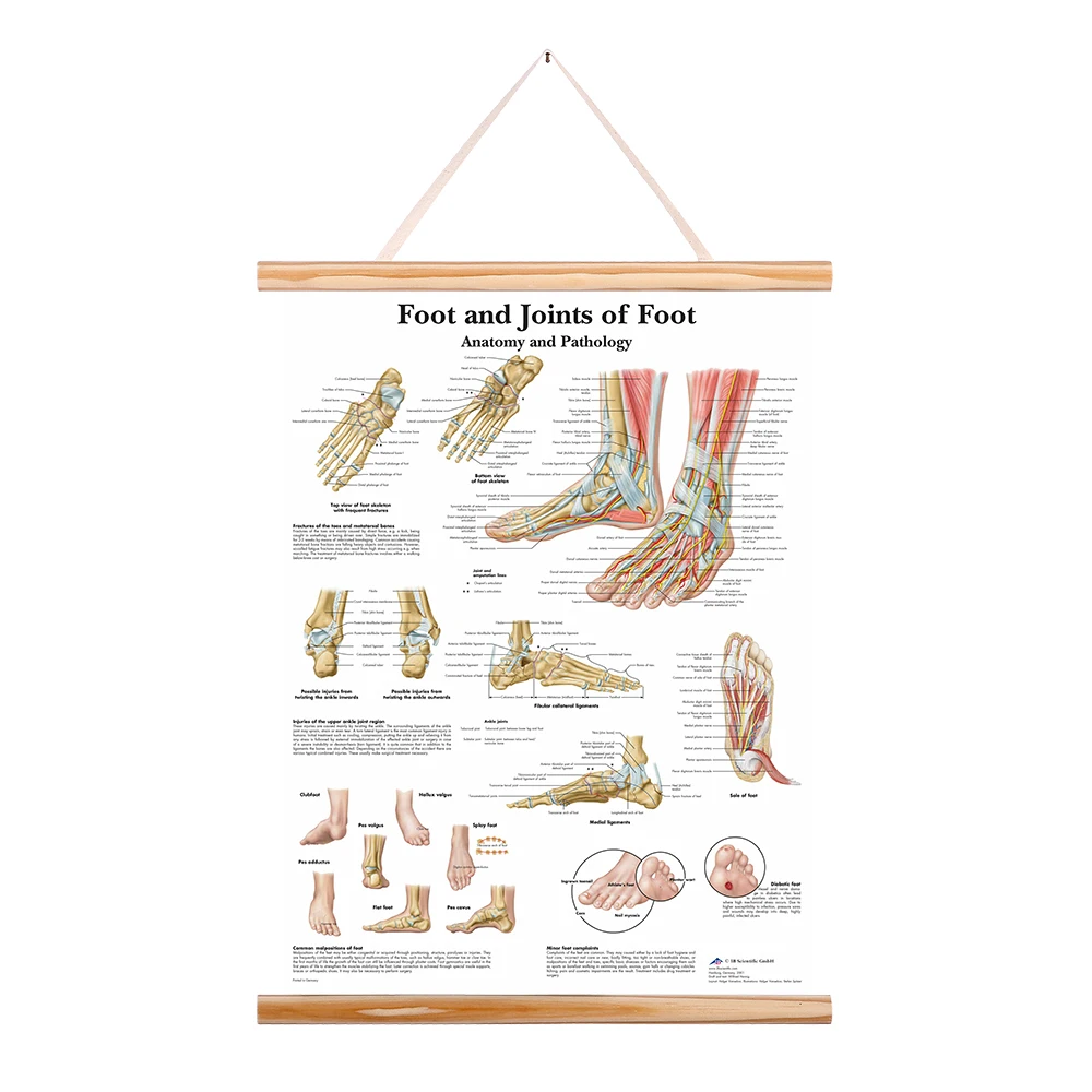 Анатомия человека мышцы руки ноги плечо ноги анатомическая диаграмма патологии плакат холст картина деревянная прокрутка картина Рамка для дома
